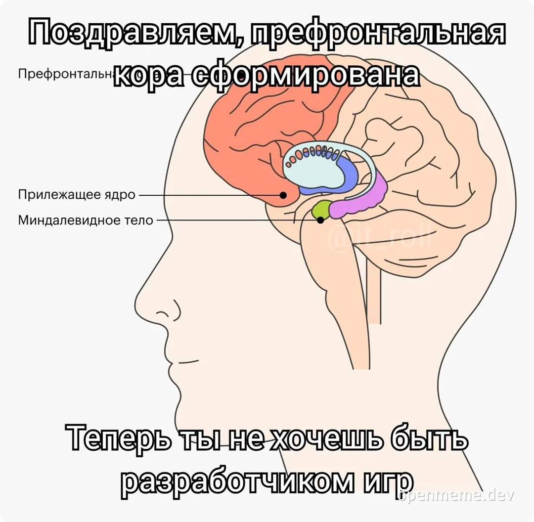 Brain illustration with labeled parts and humorous text about game development
