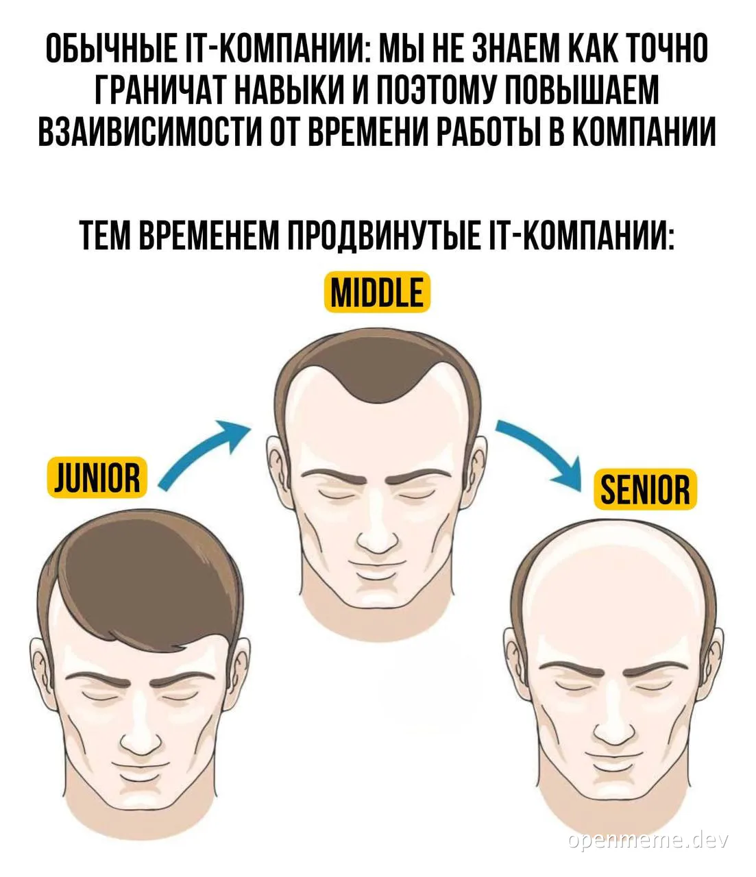 IT company skills levels and hair loss